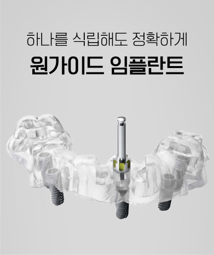 원가이드 임플란트