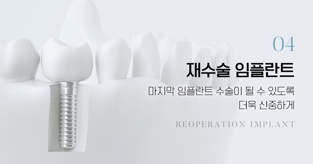 재수술 임플란트:마지막 임플란트 수술이 될 수 있도록 더욱 신중하게
